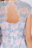 Lace Detail Short Dress